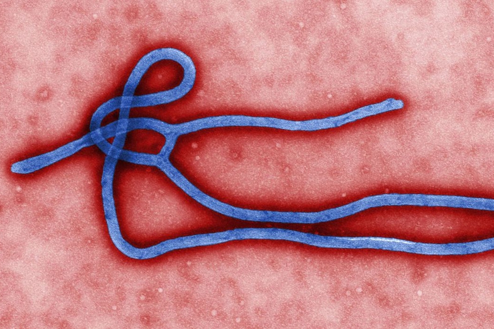 Guiné declara novo surto de ebola