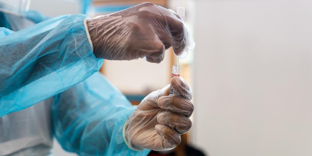 Adolescentes usam refrigerante para forjar teste positivo de Covid-19