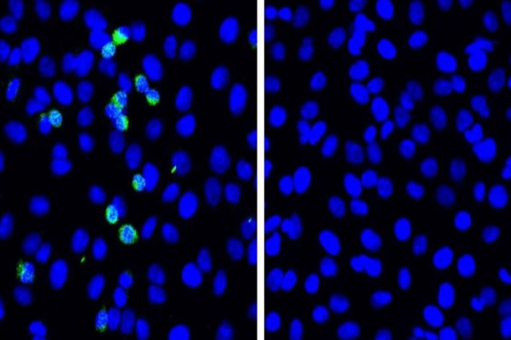 Japoneses identificam proteína que impede replicação da Covid